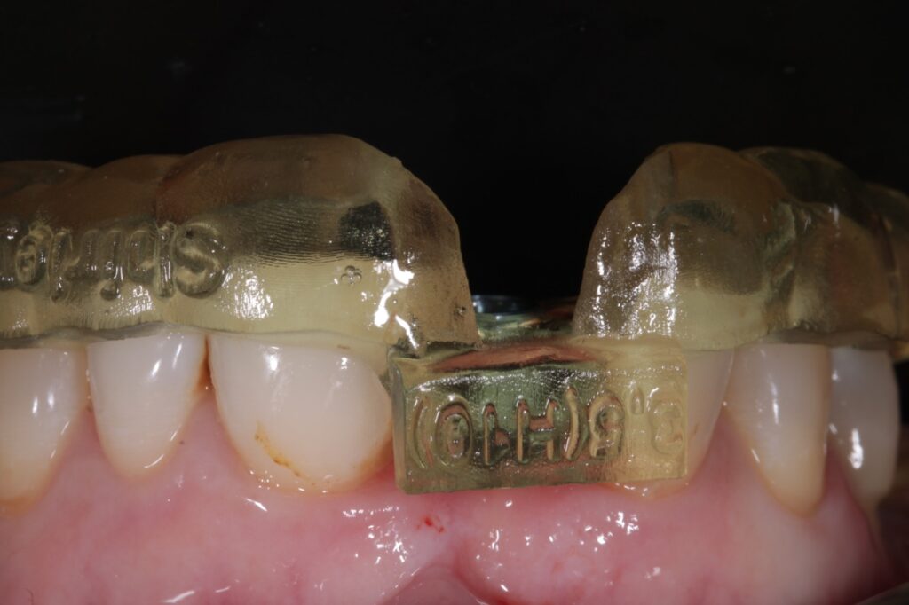 Cirurgia guiada